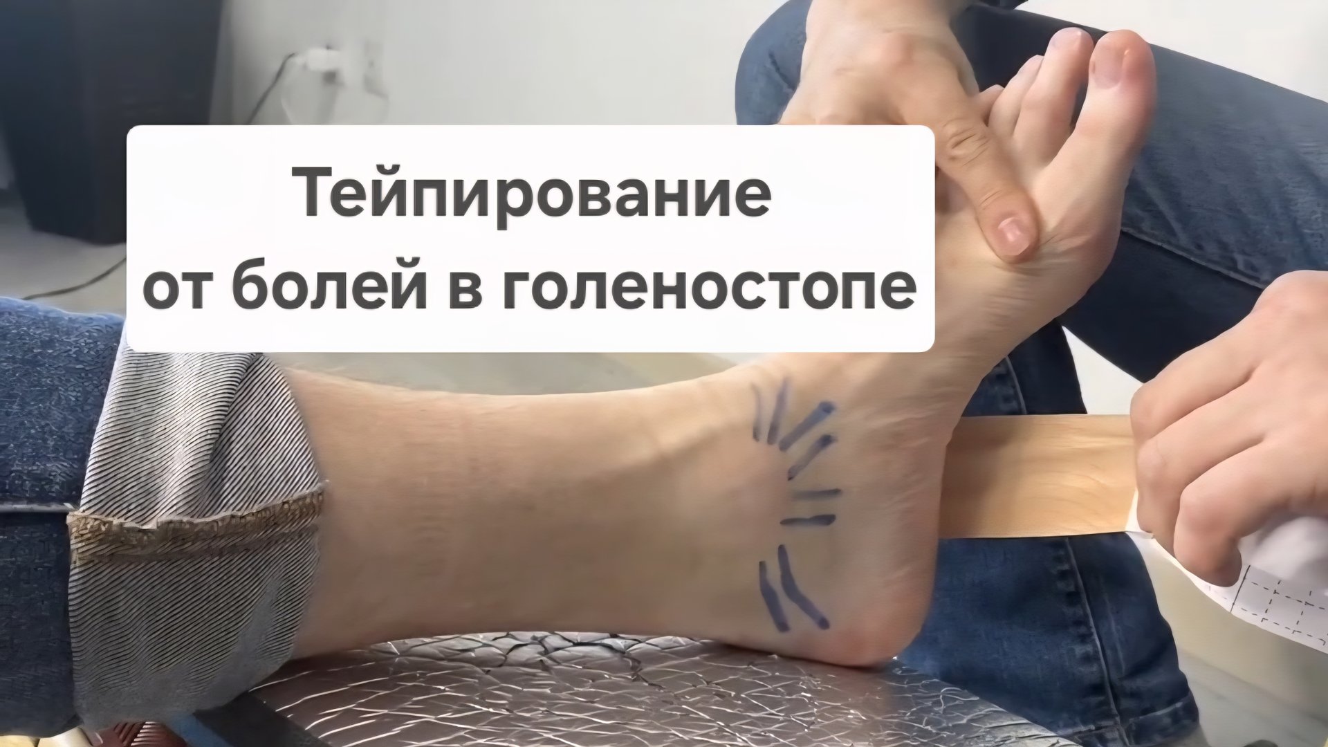 Тейпирование, от болей в голеностопе | Школа Ног смотреть онлайн