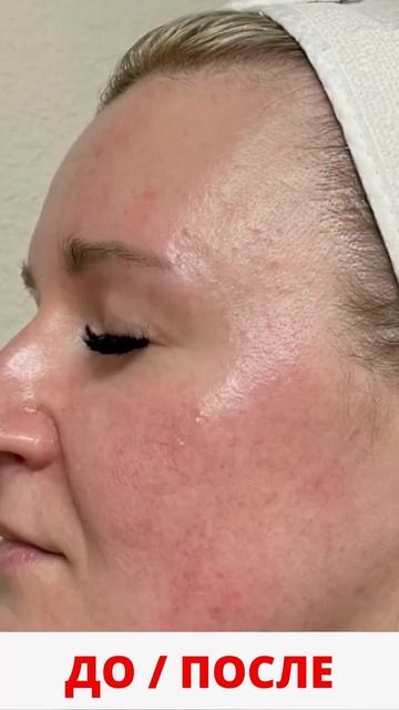 Что выдает твой возраст #гимнастикадлялица #фейсфитнес #уходзалицом #омоложениелица 824387