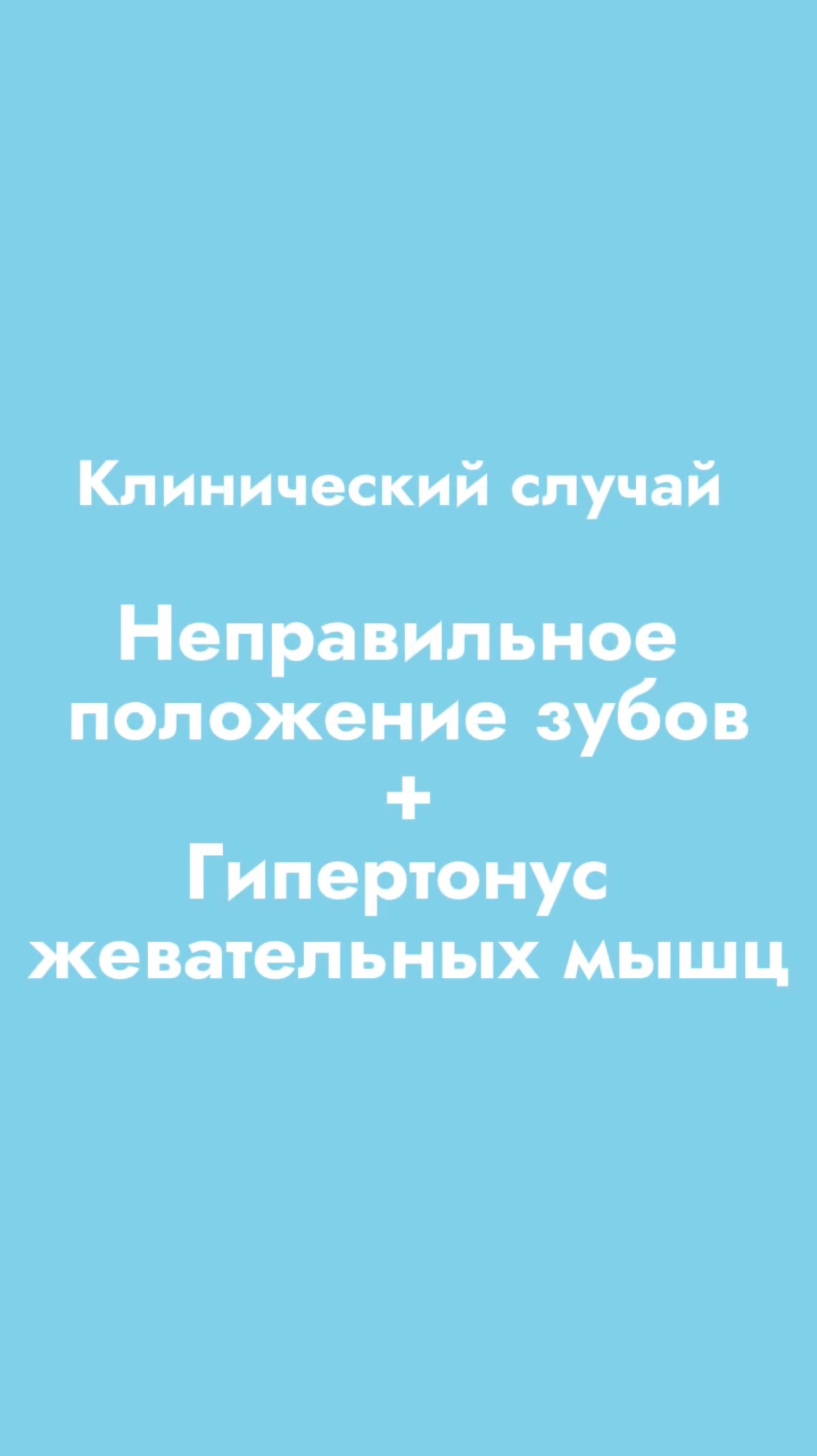 Зачем нужен ГНАТОЛОГ? Клинический случай смотреть онлайн