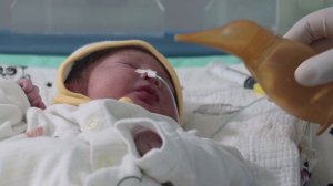 Кормление ребенка через назогастральный зонд