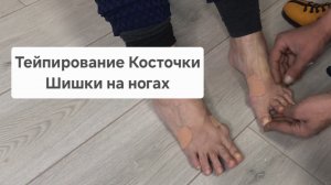 Фиксация ноги в обуви. Тейпирование, шнуровка. Плоскостопие, Косточка, Шишки на ногах