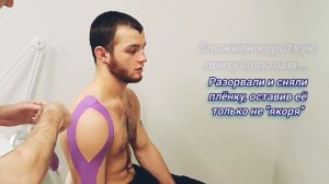 тейпирование плеча полная инструкция