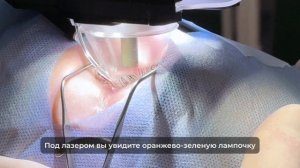 Лазерная коррекция зрения методом SmartSight