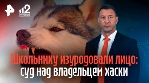 Агрессивные хаски изуродовали лицо школьнику — суд над владельцем