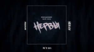 ENG | Лето, плавки, рок-н-ролл | НЕРВЫ
