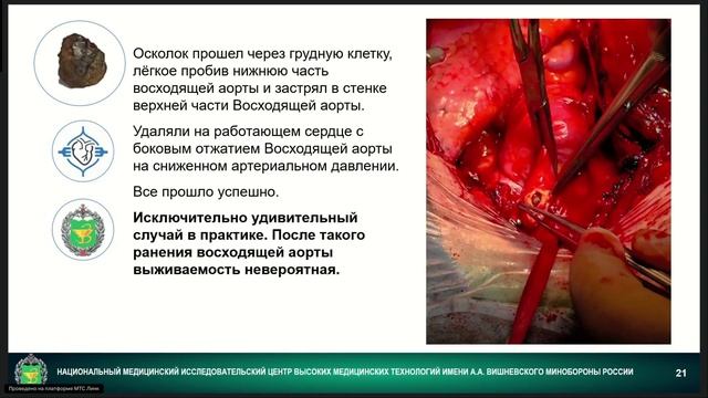 совр технологии в сосуд и кардиохирургии миниинвазивные гибридные и эндоваскулярные решения смотреть онлайн
