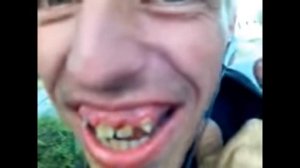 взлом первого канала #3