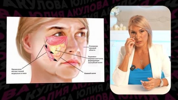 Все о процедуре FULL FACE. Лифтинг "НЕФЕРТИТИ".