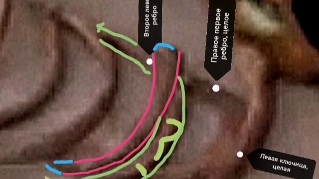 Перевал Дятлова. Второе плавающее ребро Семёна Золотарёва.