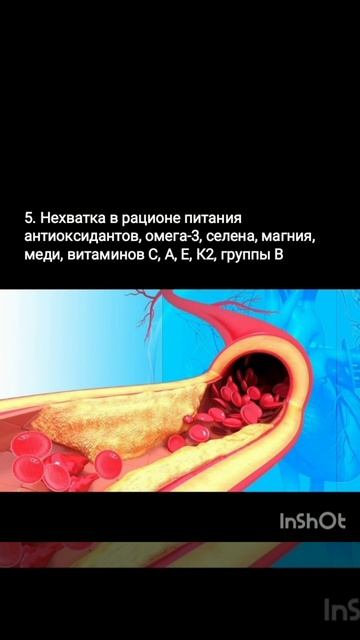 Атеросклероз сосуды сердечно-сосудистые заболевания смотреть онлайн