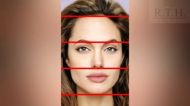 Эндоскопический лифтинг бровей смотреть онлайн