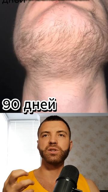 лосьон для роста бороды результаты до и после. Андрей ? смотреть онлайн