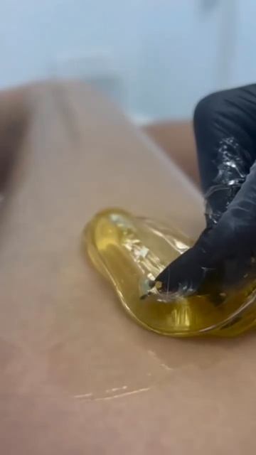 Депиляция в Epil Story #лазернаяэпиляция #депиляция #электроэпиляция #косметология смотреть онлайн