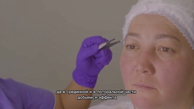 Классическая блефаропластика смотреть онлайн