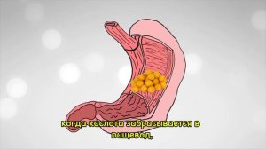 Выпей БЕТАИН Гидрохлорид- повысь кислотность желудка