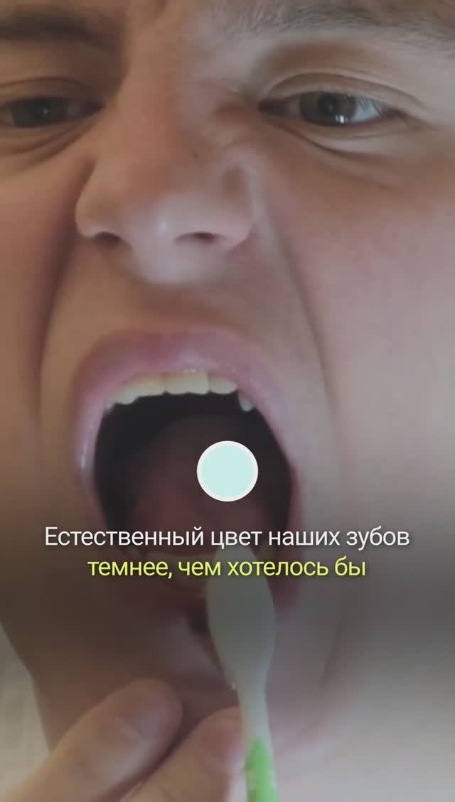 БЕЛЫЕ ЗУБЫ ПРИЗНАК ЗДОРОВЬЯ I ЗДОРОВЫЕ ЗУБЫ БЕЛЫЕ I РАЗБОР МИФА смотреть онлайн