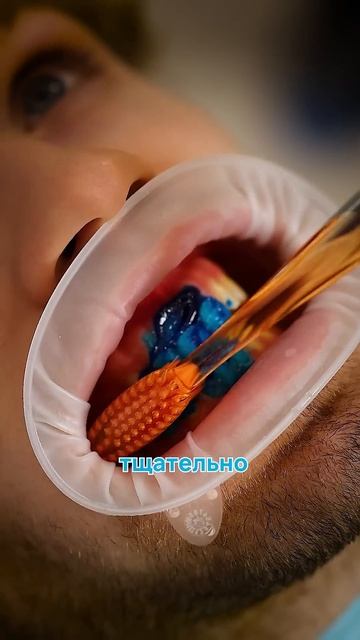 Зубная паста, которая станет вашим верным помощником! смотреть онлайн
