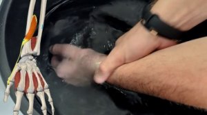 Разработка кисти и пальцев после перелома и операции.