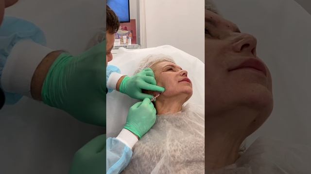 Коррекция ботулотоксином нижней трети лица. смотреть онлайн