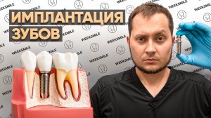 Современная имплантация зубов в клинике WEEKSMILE: качество, опыт, эксперты, анестезия, точность.