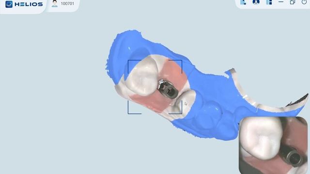 Eighteeth Helios 500: Scanning Manual for Multiple Scan Body смотреть онлайн