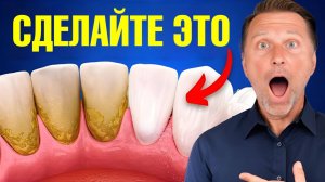 Уникальный способ удаления зубного камня и зубного налета ДОМА!🔥