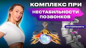 Нестабильность позвонков шейного отдела