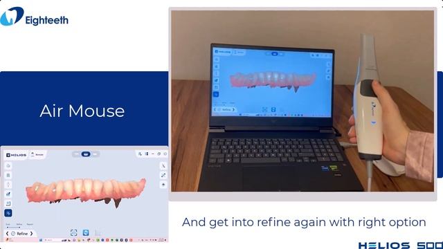 Eighteeth Helios 500： All-around Intraoral Scanner for Dentists смотреть онлайн