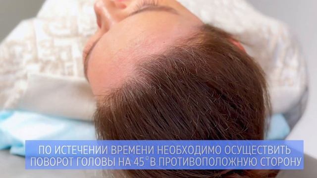 Маневр Эпли - вестибулярная реабилитация