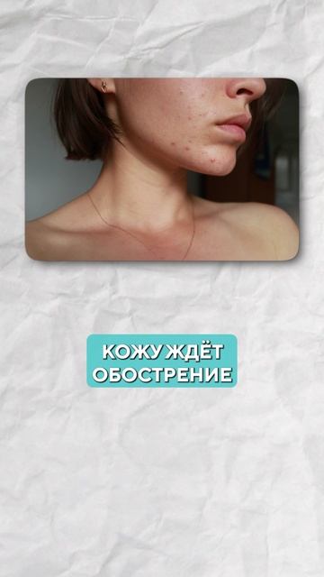 Не загорай на солнце, пока не узнаешь ЭТО! #красота #молодость #акне смотреть онлайн