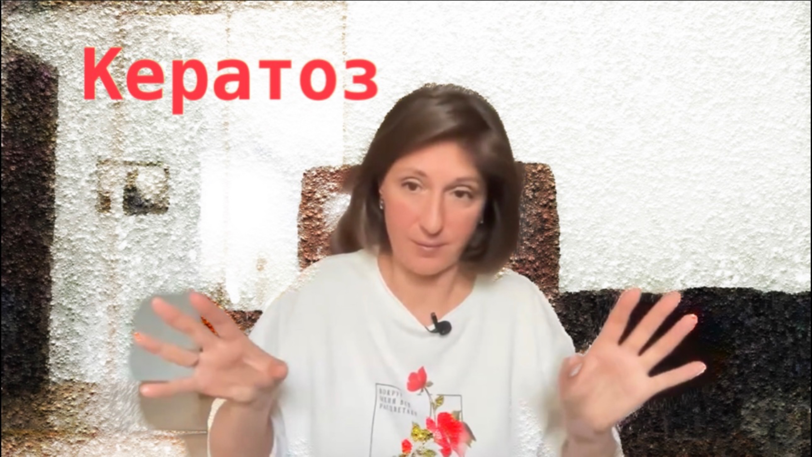 Кератоз: причины, как избавиться смотреть онлайн