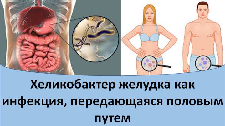 Хеликобактер как инфекция, передающаяся половым путем смотреть онлайн