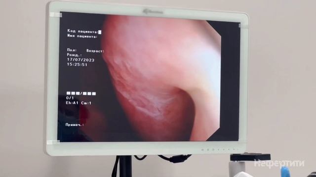 Видеоэндоскопия ЛОР-ОРГАНОВ