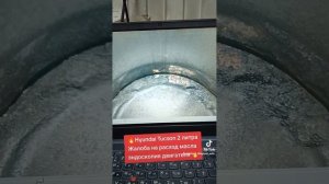 🔥Hyundai Tucson 2 литра, жалоба на расход масла, эндоскопия д