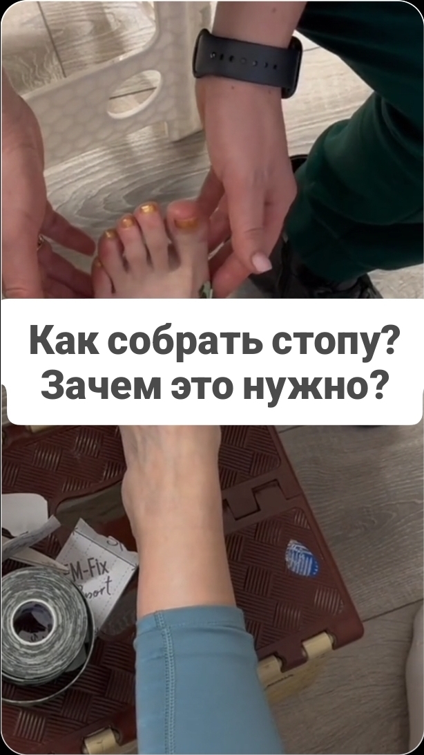 Как правильно выбрать обувь, чтобы избежать натоптышей, пяточных шпор, косточки #плоскостопие смотреть онлайн