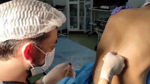 Спинномозговая анестезия  Выполняет анестезиолог Неъ