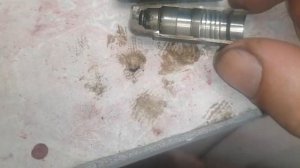 Это вызывает стук и перескок цепи ГРМ на хундай ix35