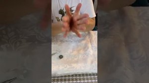 Гастриты, Изжога, область Эпигастрий. Практика Суджок