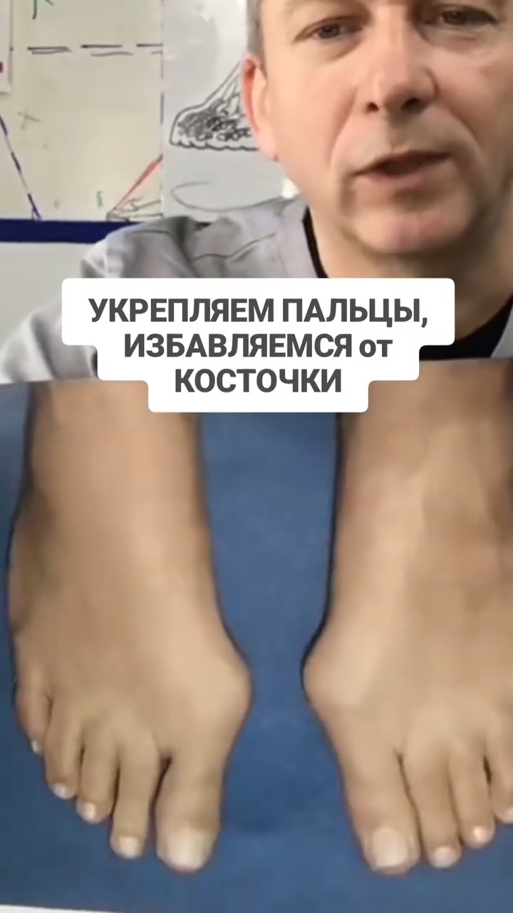 Тренируем пальцы, чтобы уменьшить косточки. Тест на координацию. смотреть онлайн