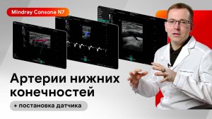 УЗИ артерий нижних конечностей и постановка датчика на Mindray Consona N7