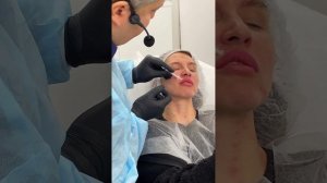 Как корректировать ботоксом десневую улыбку и кролич?