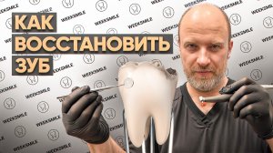 🔴 Какой метод реставрации зуба надежнее? Керамика или композит? Реставрация зубов Как чистить зубы