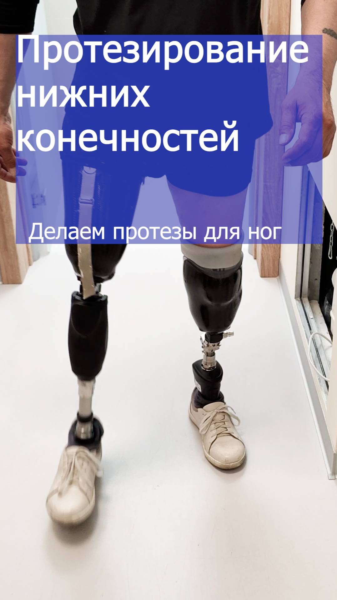 Антарес Фит - делаем протезы ног смотреть онлайн