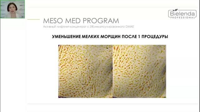 MESO MED FACE PROGRAM