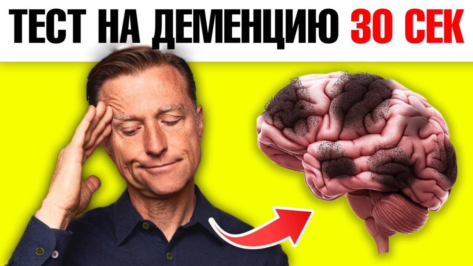 Пройдите этот тест на раннюю деменцию за 30 секунд!🔥 смотреть онлайн