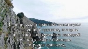 Как сделать ЭКГ ребенку без нервов и слез — Статья