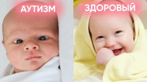 Ранние ПРИЗНАКИ АУТИЗМА! Как не пропустить тревожные симптомы у ребёнка?