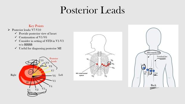 8.Posterior Leads смотреть онлайн