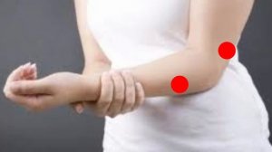 Воспаление локтевого сустава. Витафон. Схема лечения.