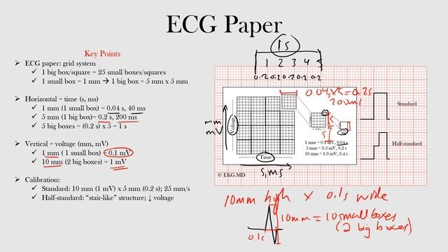 9.ECG Paper смотреть онлайн